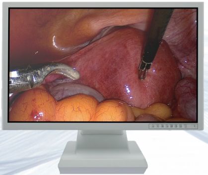 Top 1 Sistem laparoskop definisi tinggi Sistem endoskop tegar (6)